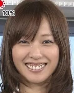 戸田恵梨香は歯並びを歯列矯正で治療した 歯茎が出るのは整形で顔変わったのが理由 気になるあのエンタメ