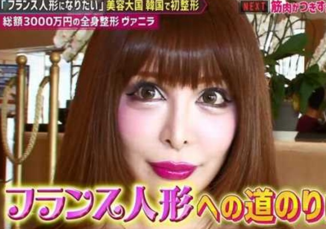 ヴァニラの整形前と現在の顔が変わりすぎて別人?昔の元の顔やすっぴんも違うか画像で比較! | 気になるあのエンタメ!