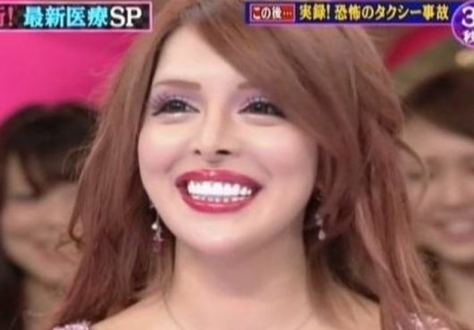 ヴァニラの整形前と現在の顔が変わりすぎて別人?昔の元の顔やすっぴんも違うか画像で比較! | 気になるあのエンタメ!
