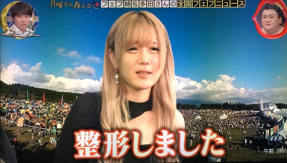 フェフ姉の友達・多田さんの整形前と後を画像で比較！鼻をイジって顔変わったか過去の画像 …