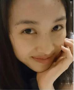 百田夏菜子は八重歯を矯正して可愛いくなった？高校の卒アルやすっぴん素顔と画像で比較！