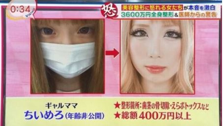 ちいめろは整形前から鼻をイジって顔変わった?すっぴんや昔から別人に変化したか画像で比較! | 気になるあのエンタメ!