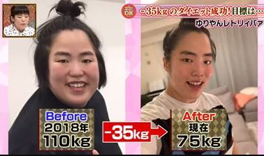 ゆりやんレトリィバァの現在は痩せたし目も二重に？ダイエットで減量する前の昔の画像と比較！ | 気になるあのエンタメ！